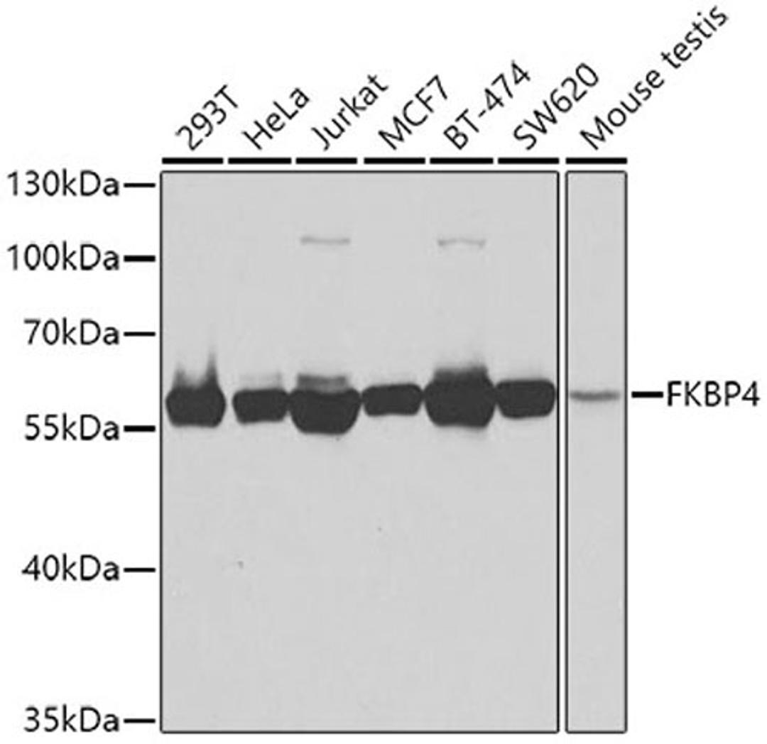 Western blot - FKBP4 antibody (A5643)