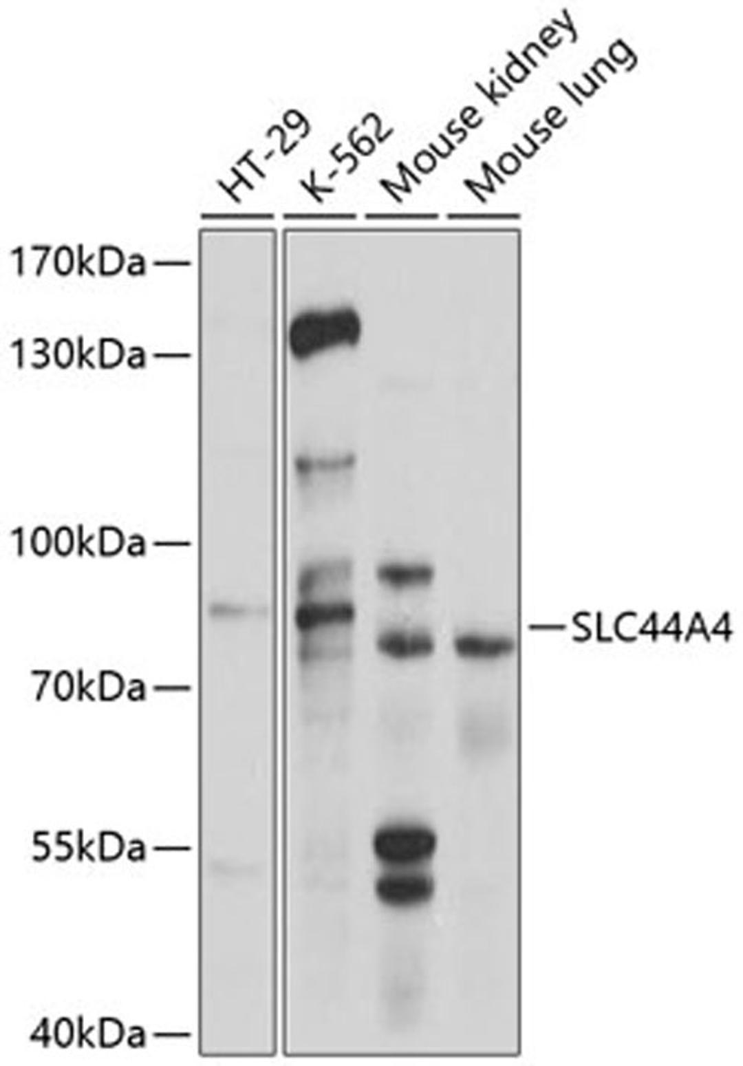 Western blot - SLC44A4 antibody (A10435)