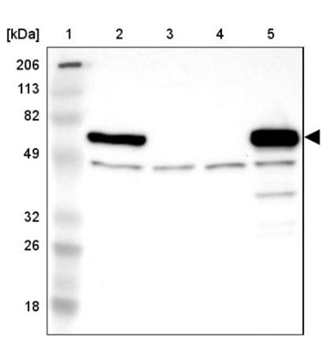 Western Blot: Monoamine Oxidase B Antibody [NBP1-87493] - Lane 1: Marker [kDa] 206, 113, 82, 49, 32, 26, 18<br/>Lane 2: Human cell line RT-4<br/>Lane 3: Human cell line U-251MG sp<br/>Lane 4: Human cell line A-431<br/>Lane 5: Human liver tissue