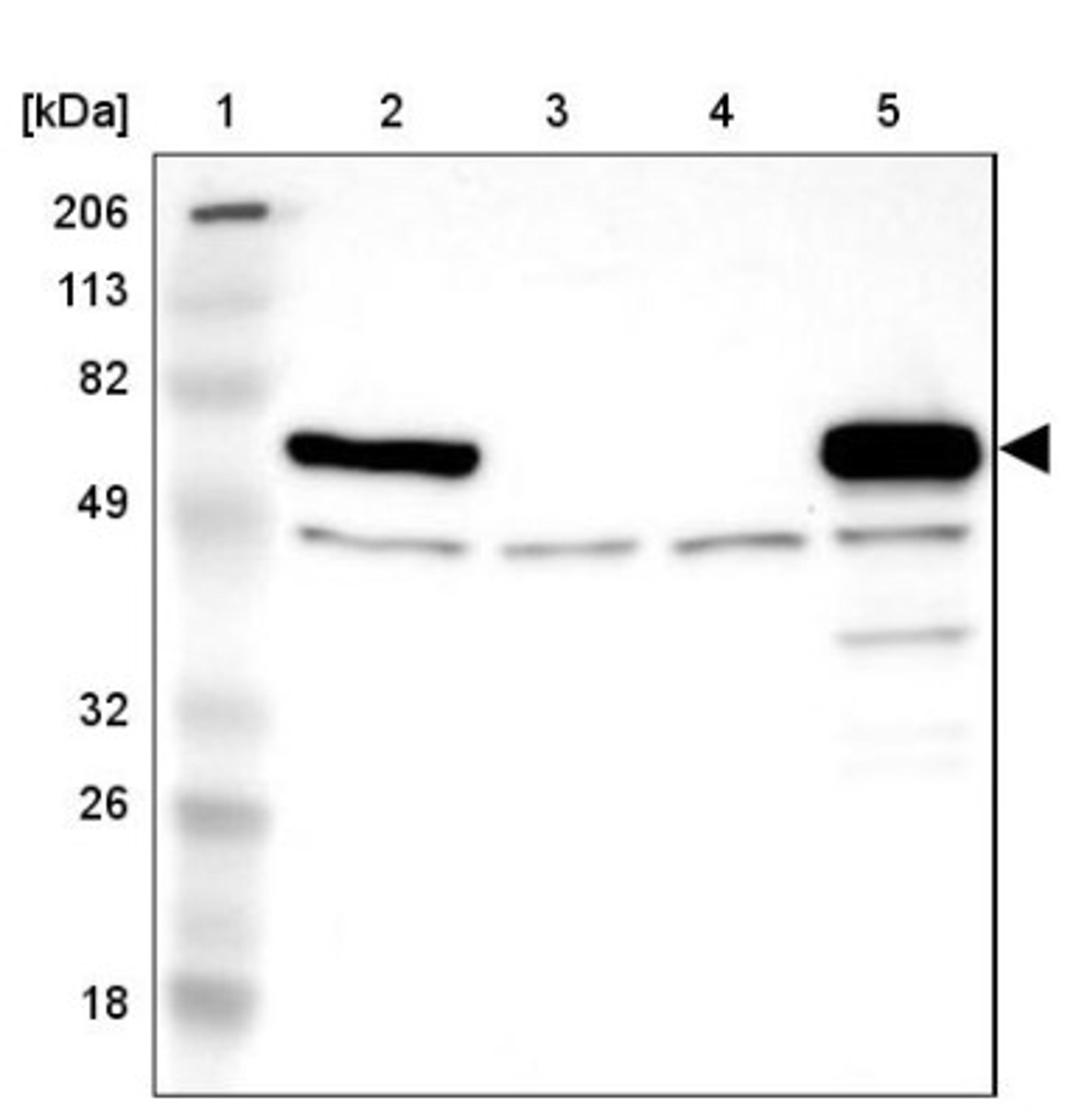 Western Blot: Monoamine Oxidase B Antibody [NBP1-87493] - Lane 1: Marker [kDa] 206, 113, 82, 49, 32, 26, 18<br/>Lane 2: Human cell line RT-4<br/>Lane 3: Human cell line U-251MG sp<br/>Lane 4: Human cell line A-431<br/>Lane 5: Human liver tissue