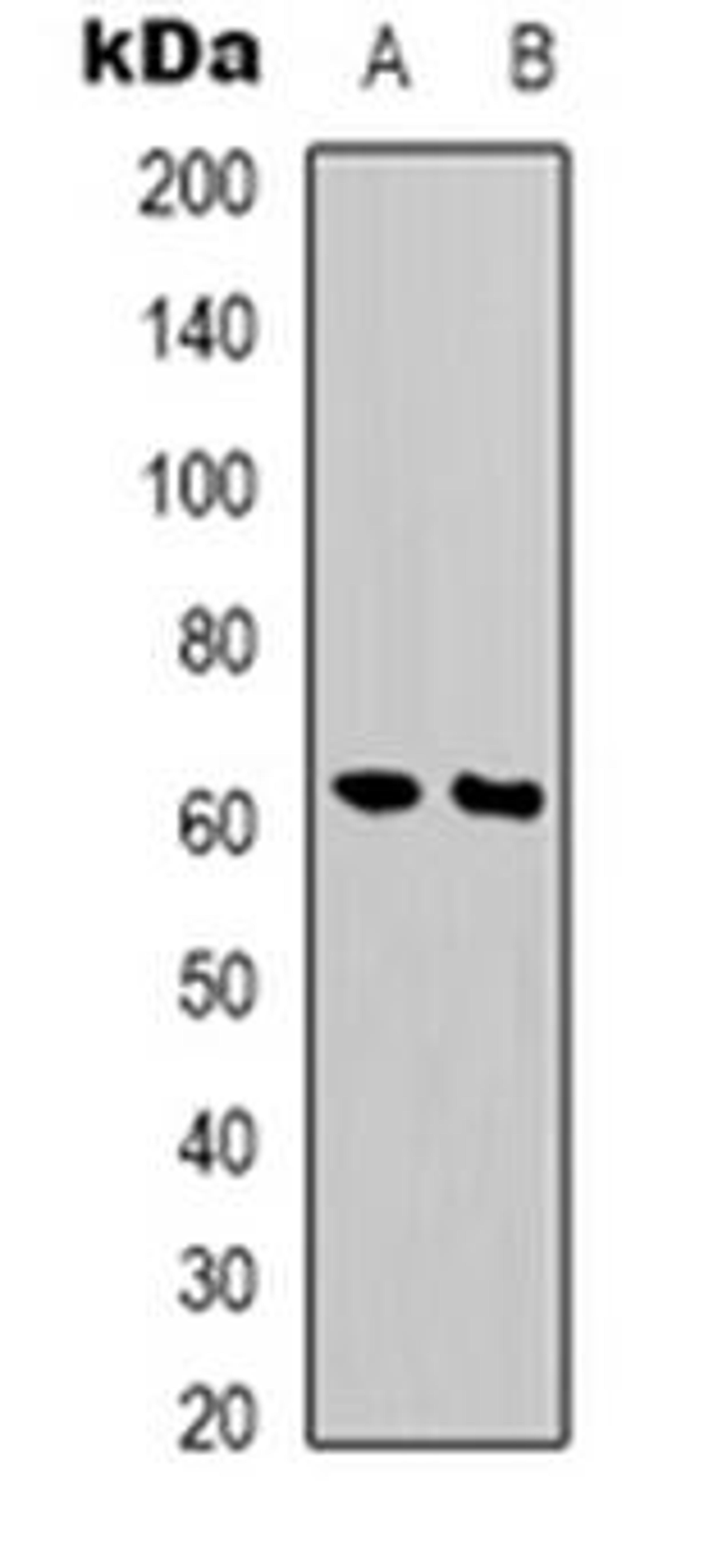 Western blot analysis of PHF1 expression in MCF7 (Lane 1), Jurkat (Lane 2) whole cell lysates using PHF1 antibody