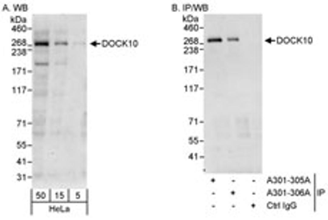 Detection of human DOCK10 by western blot and immunoprecipitation.