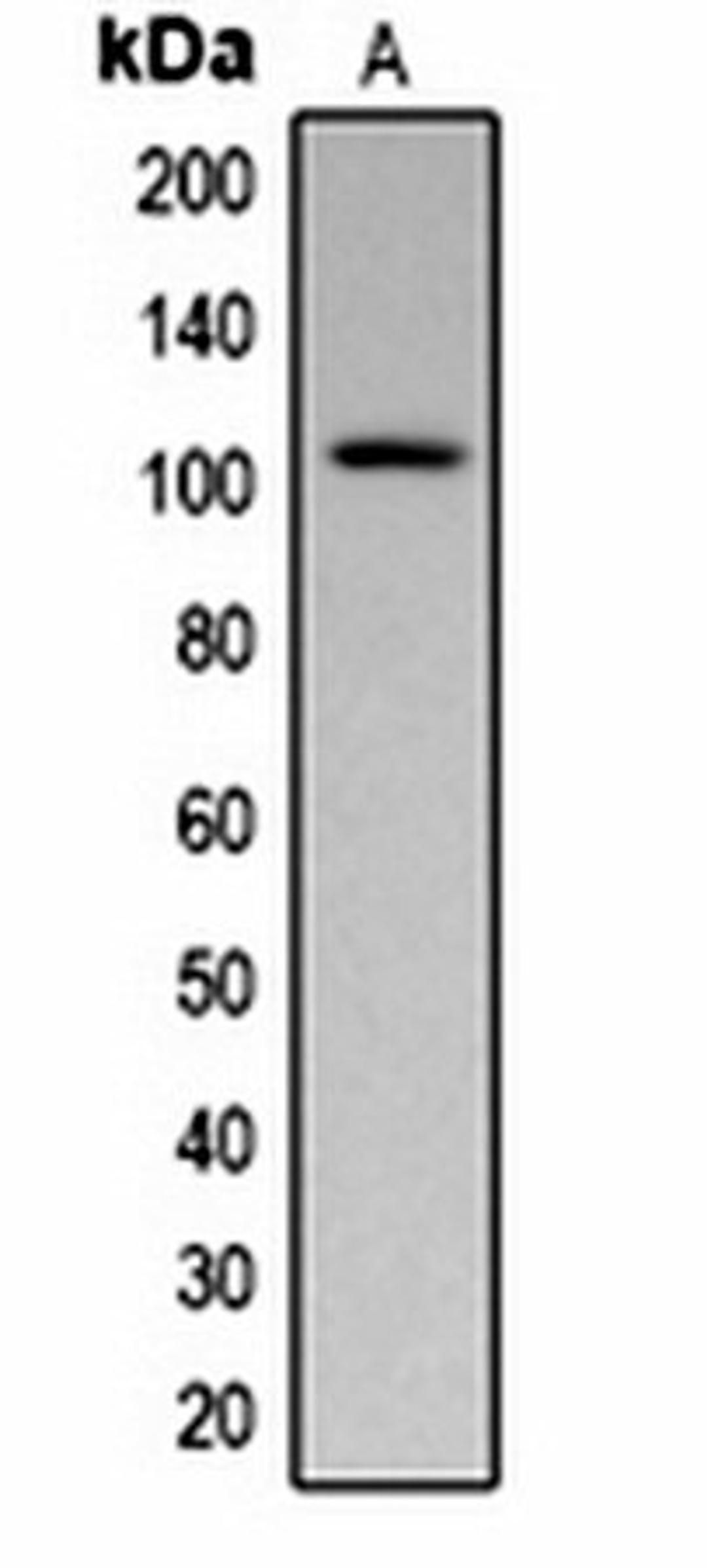 Western blot analysis of  Maize (Lane1) whole cell lysates using Pepsinogen C antibody