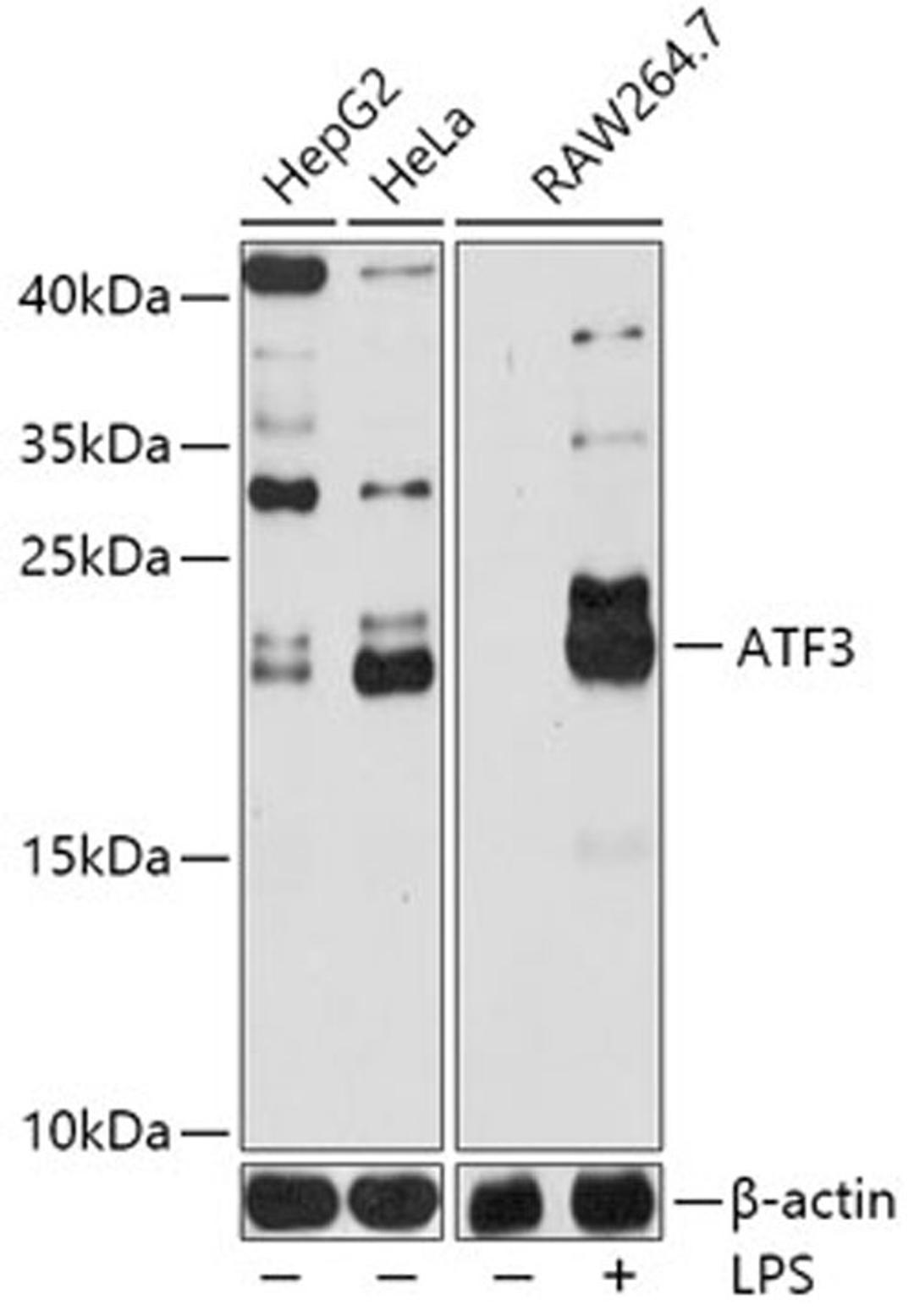 Western blot - ATF3 antibody (A13469)