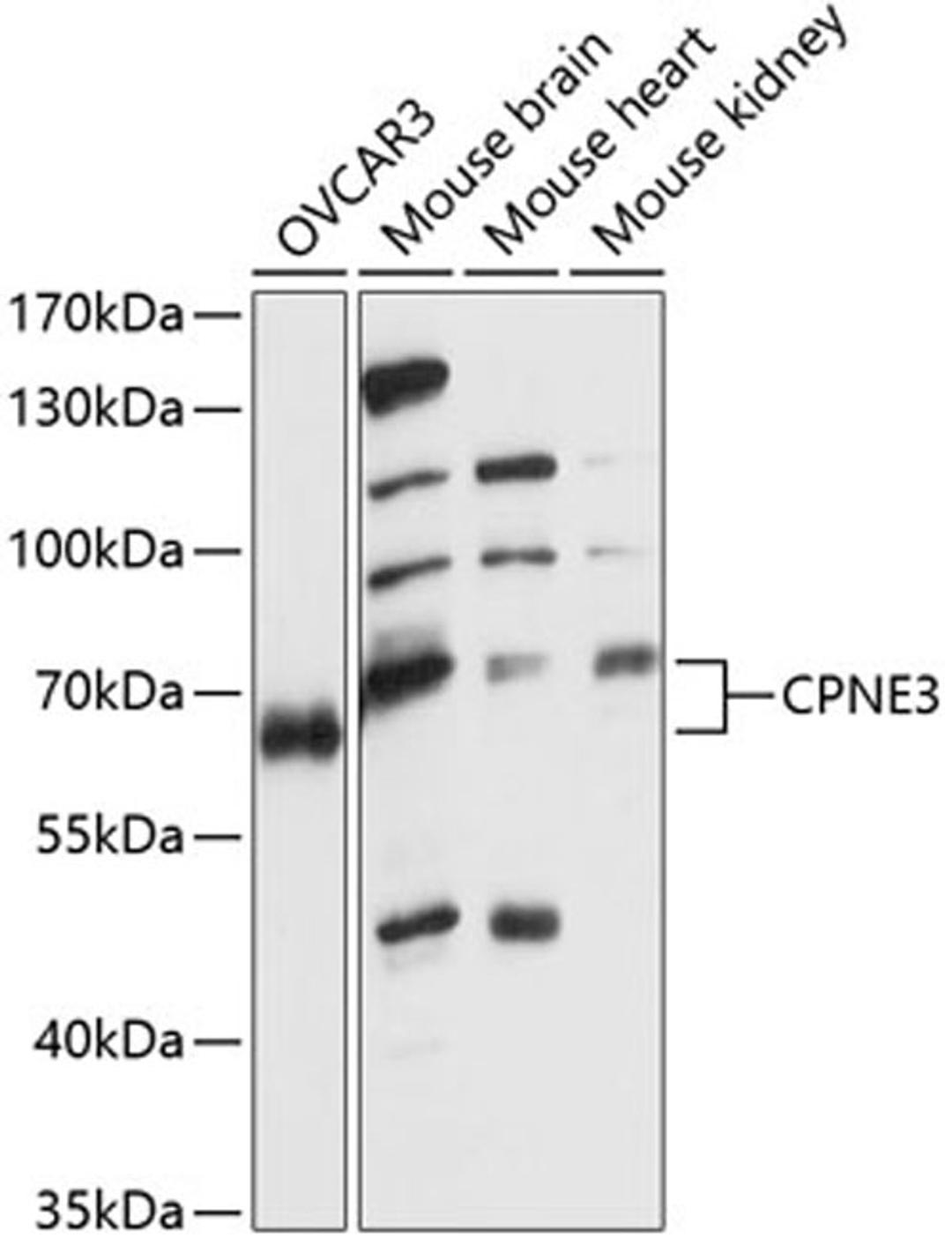 Western blot - CPNE3 antibody (A14689)