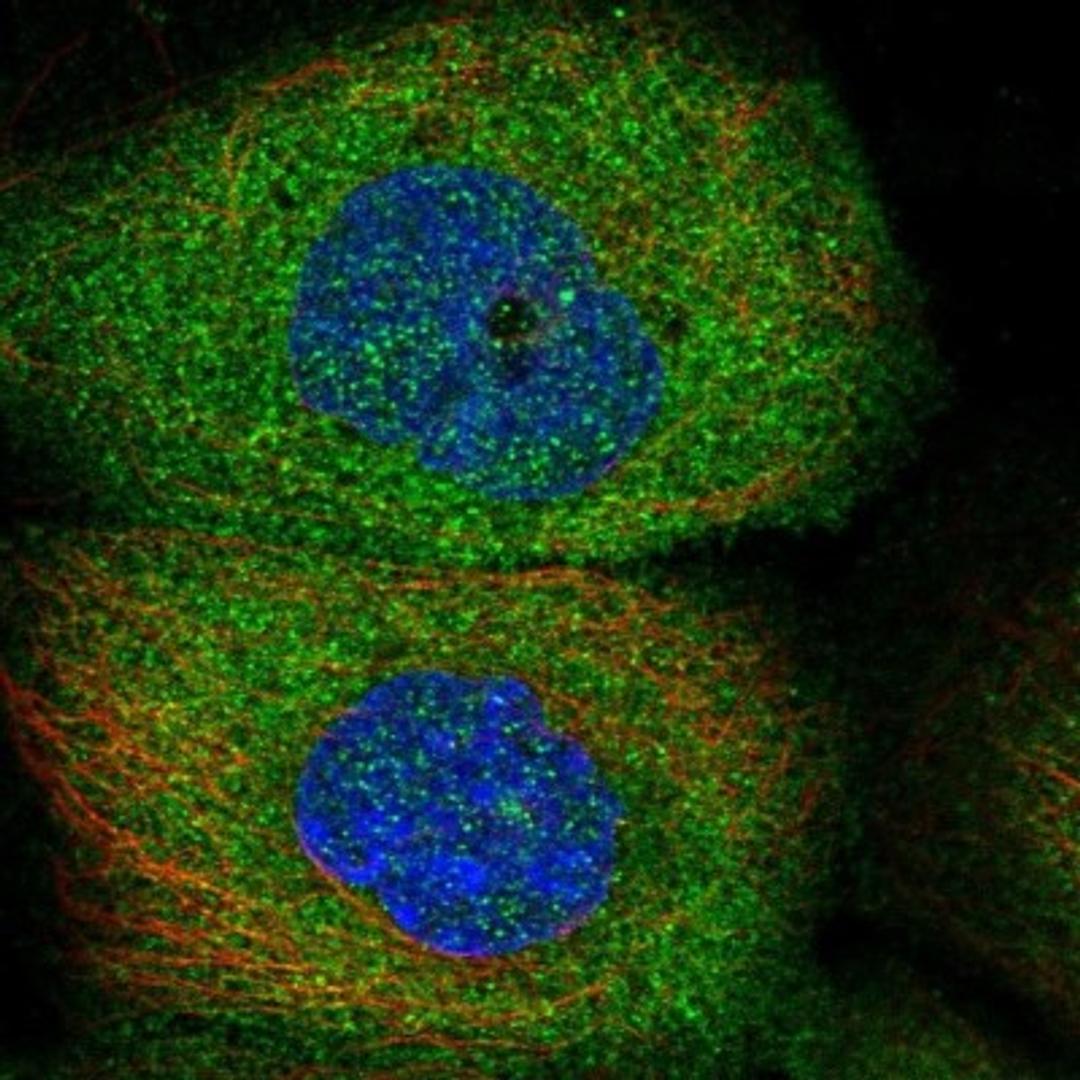 Immunocytochemistry/Immunofluorescence: TRAM2 Antibody [NBP1-83052] - Staining of human cell line A-431 shows positivity in cytoplasm.