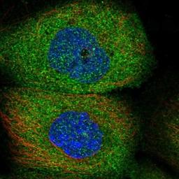 Immunocytochemistry/Immunofluorescence: TRAM2 Antibody [NBP1-83052] - Staining of human cell line A-431 shows positivity in cytoplasm.