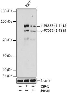 Western blot - Phospho-P70S6K1-T389 antibody (AP1059)