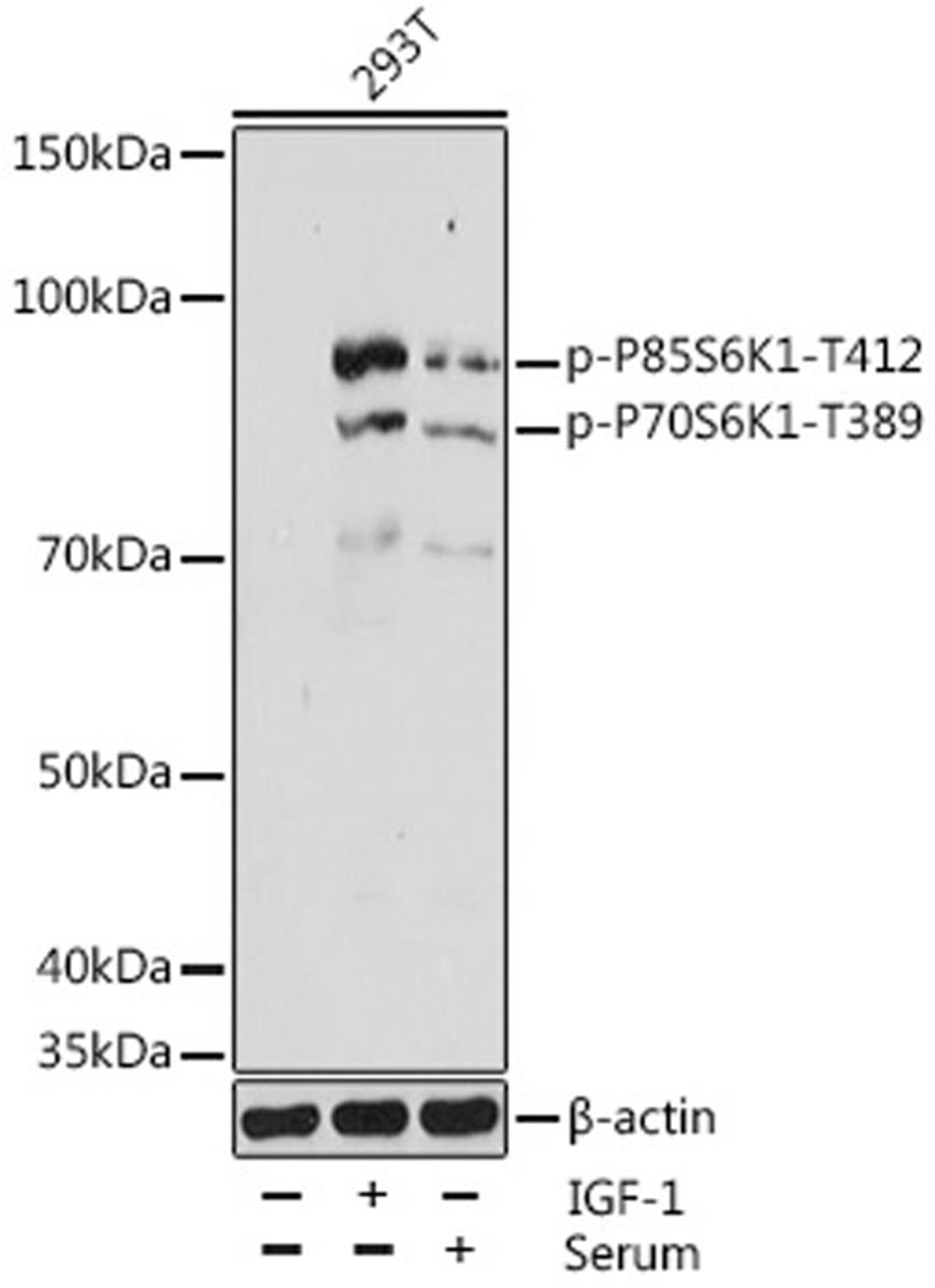 Western blot - Phospho-P70S6K1-T389 antibody (AP1059)