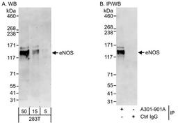 Detection of human eNOS by WB and IP.