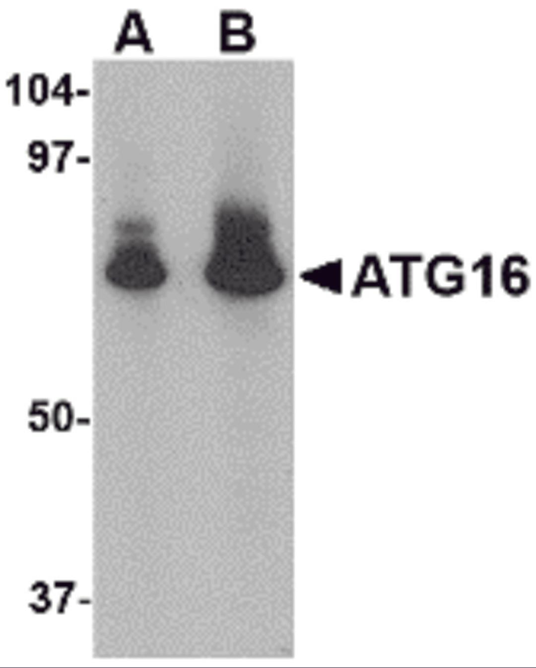 Western blot analysis of ATG16 in HeLa cell lysate with ATG16 antibody at (A) 1 and (B) 2 &#956;g/mL.