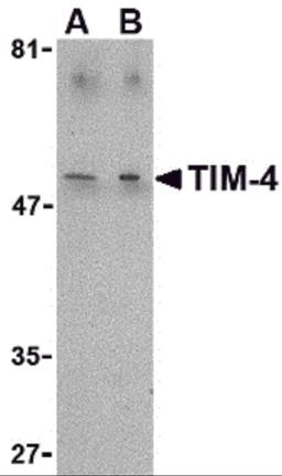 Western blot analysis of TIM-4 in Jurkat lysate with TIM-4 antibody at (A) 1 and (B) 2 &#956;g/mL.