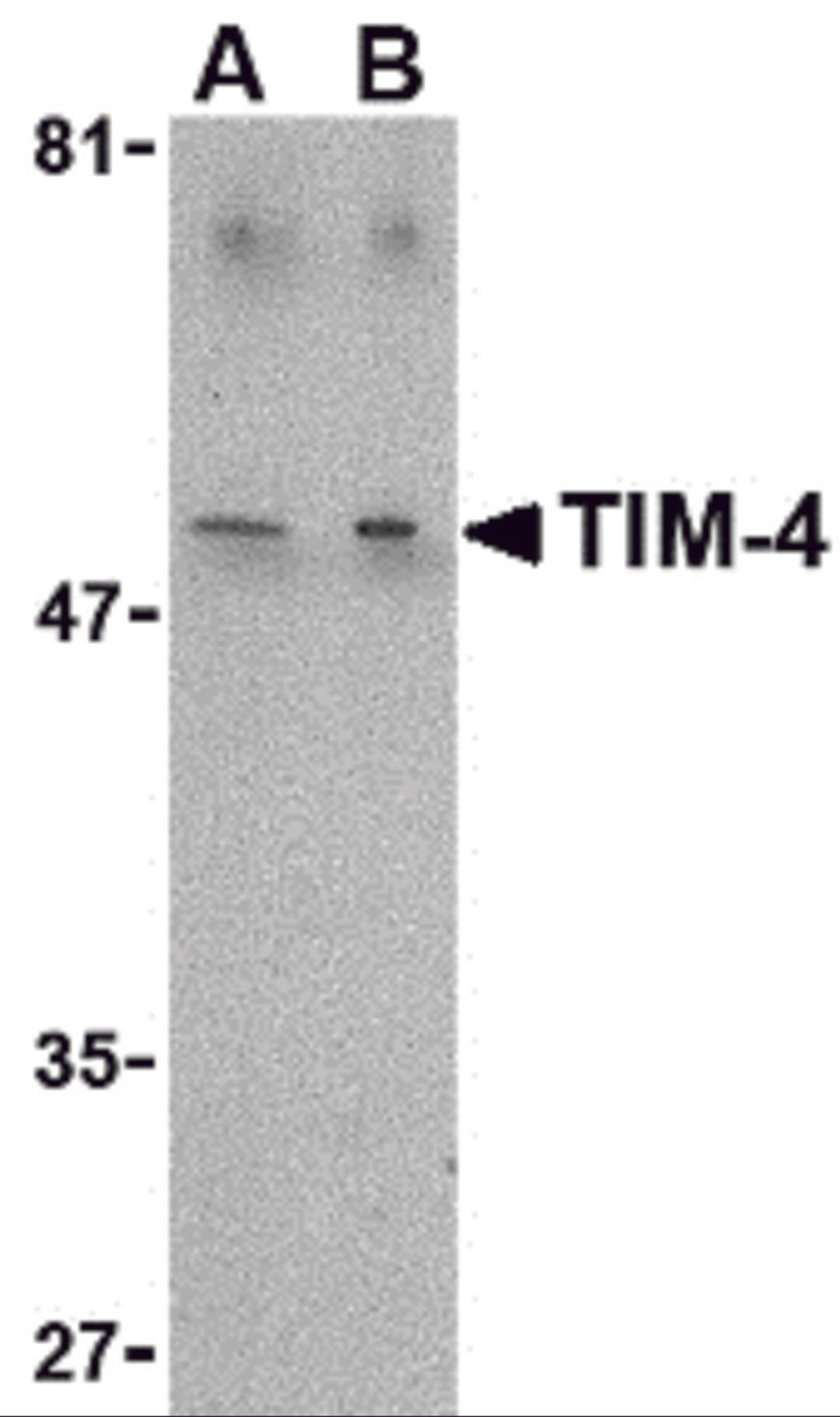 Western blot analysis of TIM-4 in Jurkat lysate with TIM-4 antibody at (A) 1 and (B) 2 μg/mL.