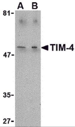Western blot analysis of TIM-4 in Jurkat lysate with TIM-4 antibody at (A) 1 and (B) 2 μg/mL.