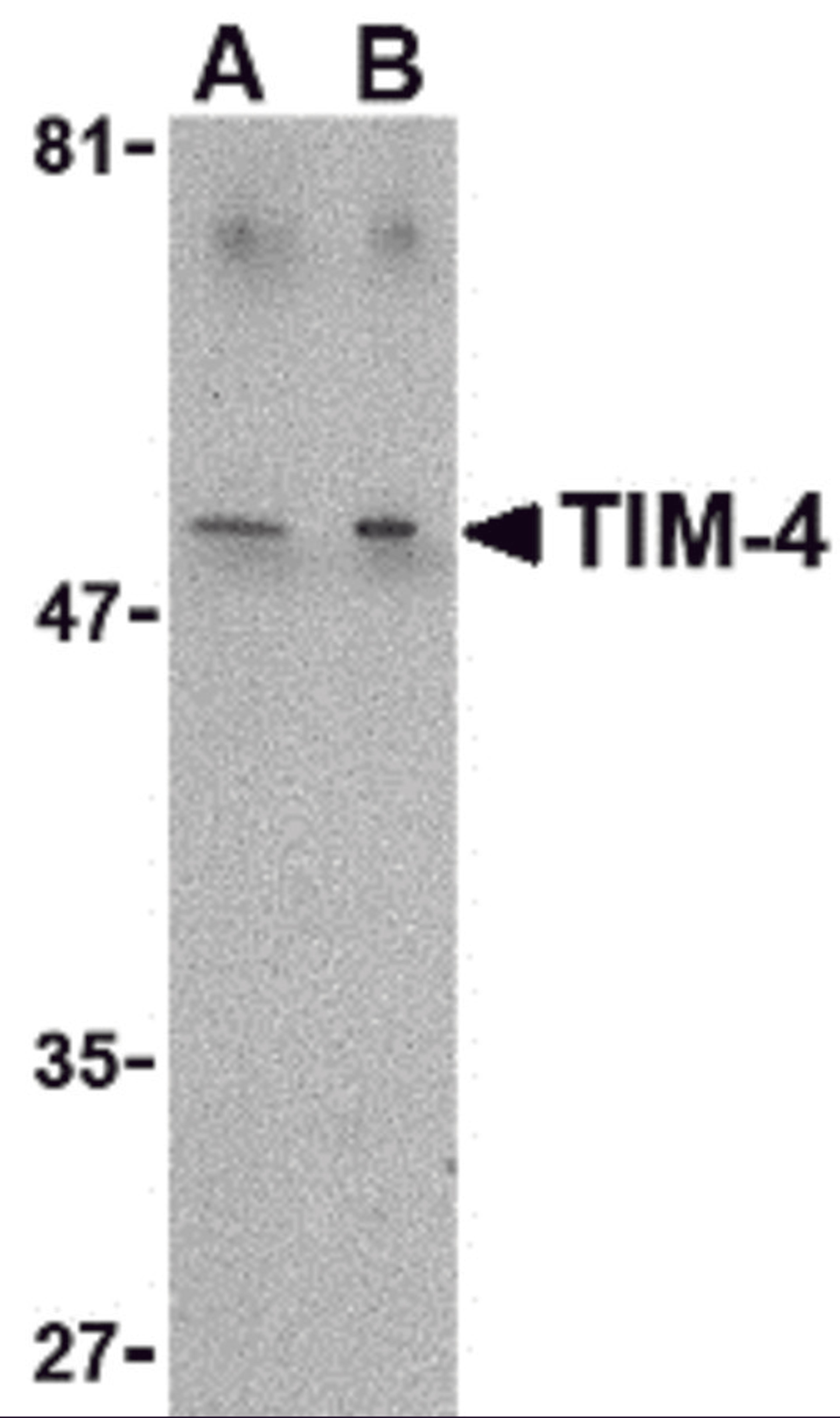 Western blot analysis of TIM-4 in Jurkat lysate with TIM-4 antibody at (A) 1 and (B) 2 μg/mL.