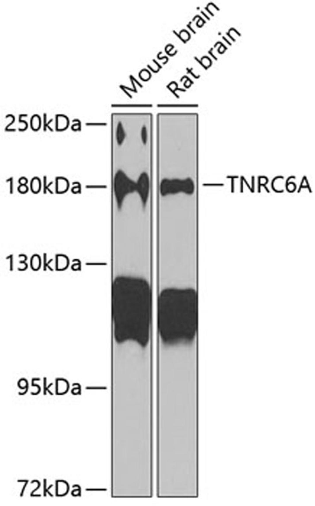 Western blot - TNRC6A antibody (A6115)