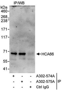 Detection of human HCA66 by western blot of immunoprecipitates.