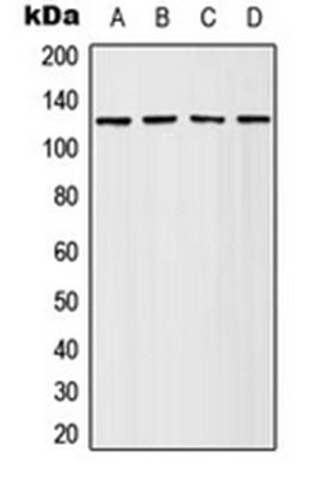 Western blot analysis of HeLa (Lane 1), Jurkat (Lane 2), SP2/0 (Lane 3), PC12 (Lane 4) whole cell lysates using Adenylate Cyclase 4 antibody