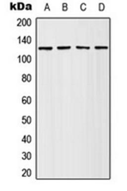 Western blot analysis of HeLa (Lane 1), Jurkat (Lane 2), SP2/0 (Lane 3), PC12 (Lane 4) whole cell lysates using Adenylate Cyclase 4 antibody