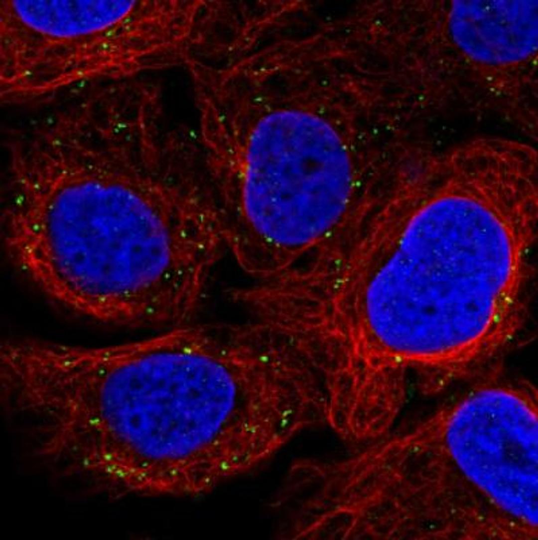 Immunoblotting: VPS26 Antibody (CL2287) [NBP2-36754] -  Staining in U2OS cell line with Anti-VSP26A monoclonal antibody, showing distinct staining of endosomes in green. Microtubule- and nuclear probes are visualized in red and blue respectively (where available). Antibody staining is shown in green.