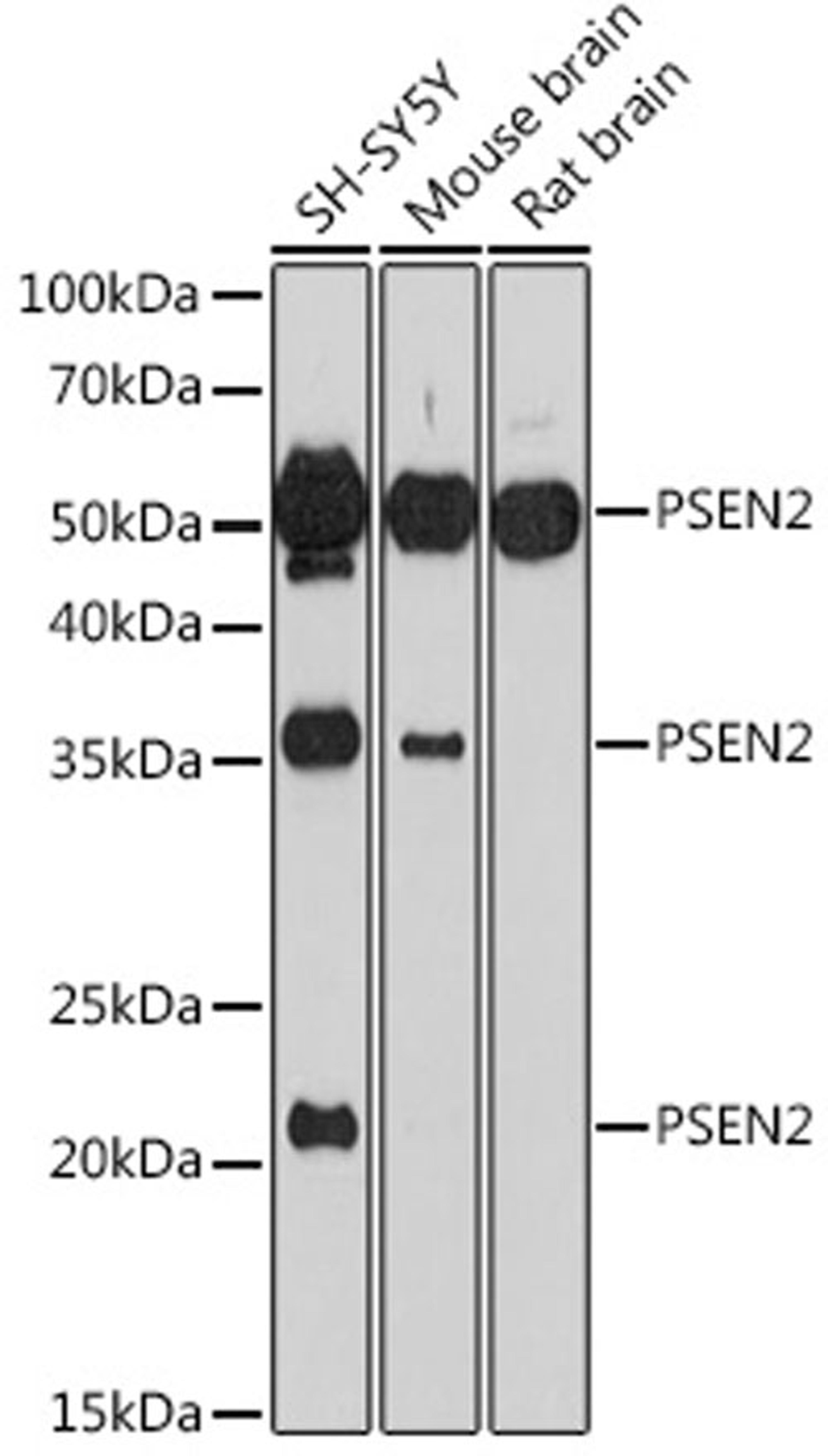 Western blot - PSEN2 antibody (A7719)