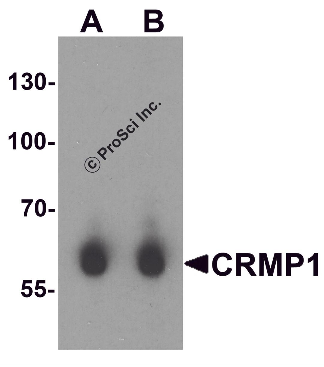 Western blot analysis of CRMP1 in human brain tissue lysate with CRMP1 antibody at (A) 1 and (B) 2 &#956;g/mL.