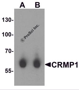 Western blot analysis of CRMP1 in human brain tissue lysate with CRMP1 antibody at (A) 1 and (B) 2 &#956;g/mL.