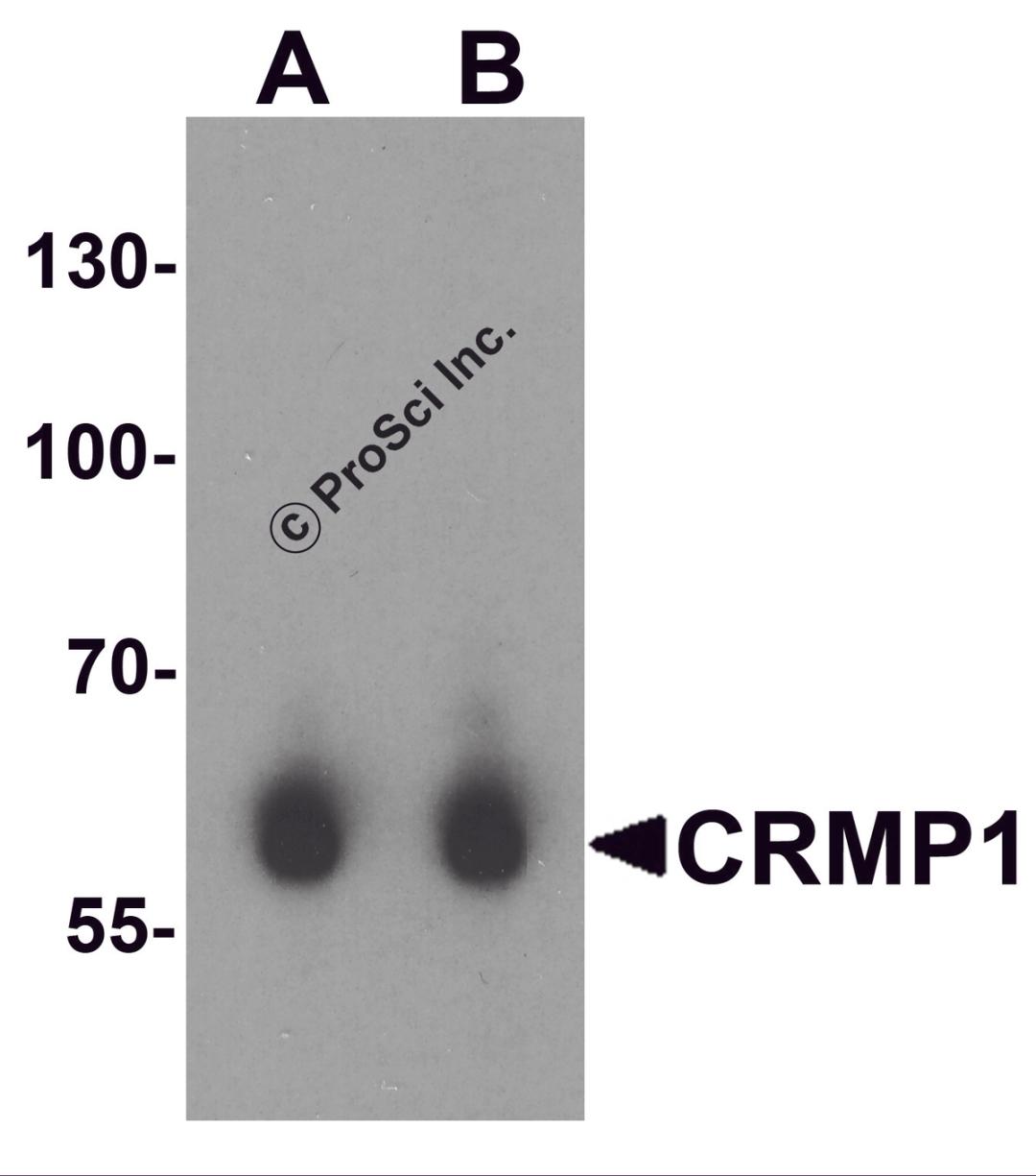 Western blot analysis of CRMP1 in human brain tissue lysate with CRMP1 antibody at (A) 1 and (B) 2 μg/mL.