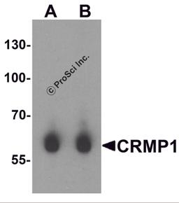 Western blot analysis of CRMP1 in human brain tissue lysate with CRMP1 antibody at (A) 1 and (B) 2 μg/mL.