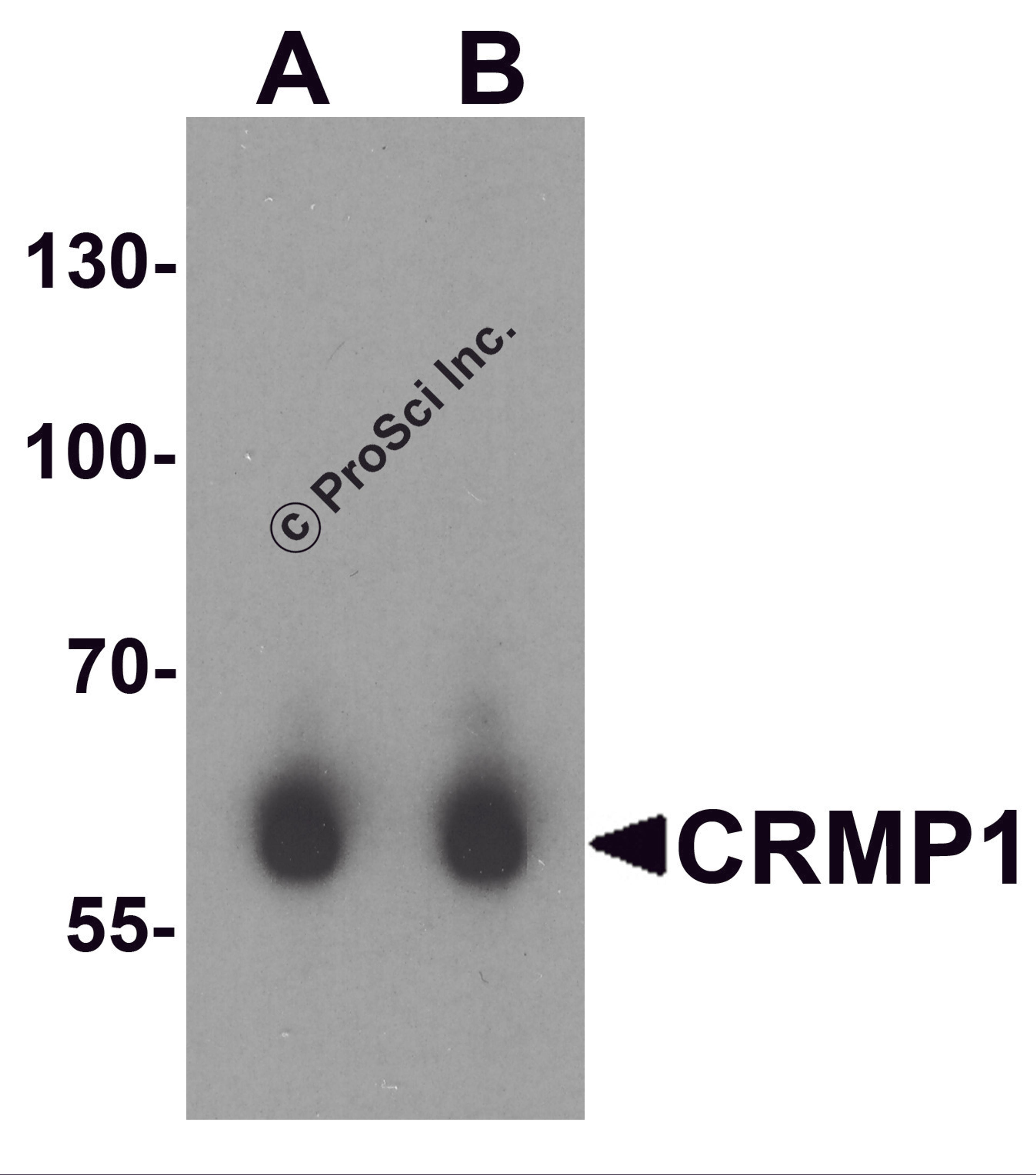 Western blot analysis of CRMP1 in human brain tissue lysate with CRMP1 antibody at (A) 1 and (B) 2 μg/mL.
