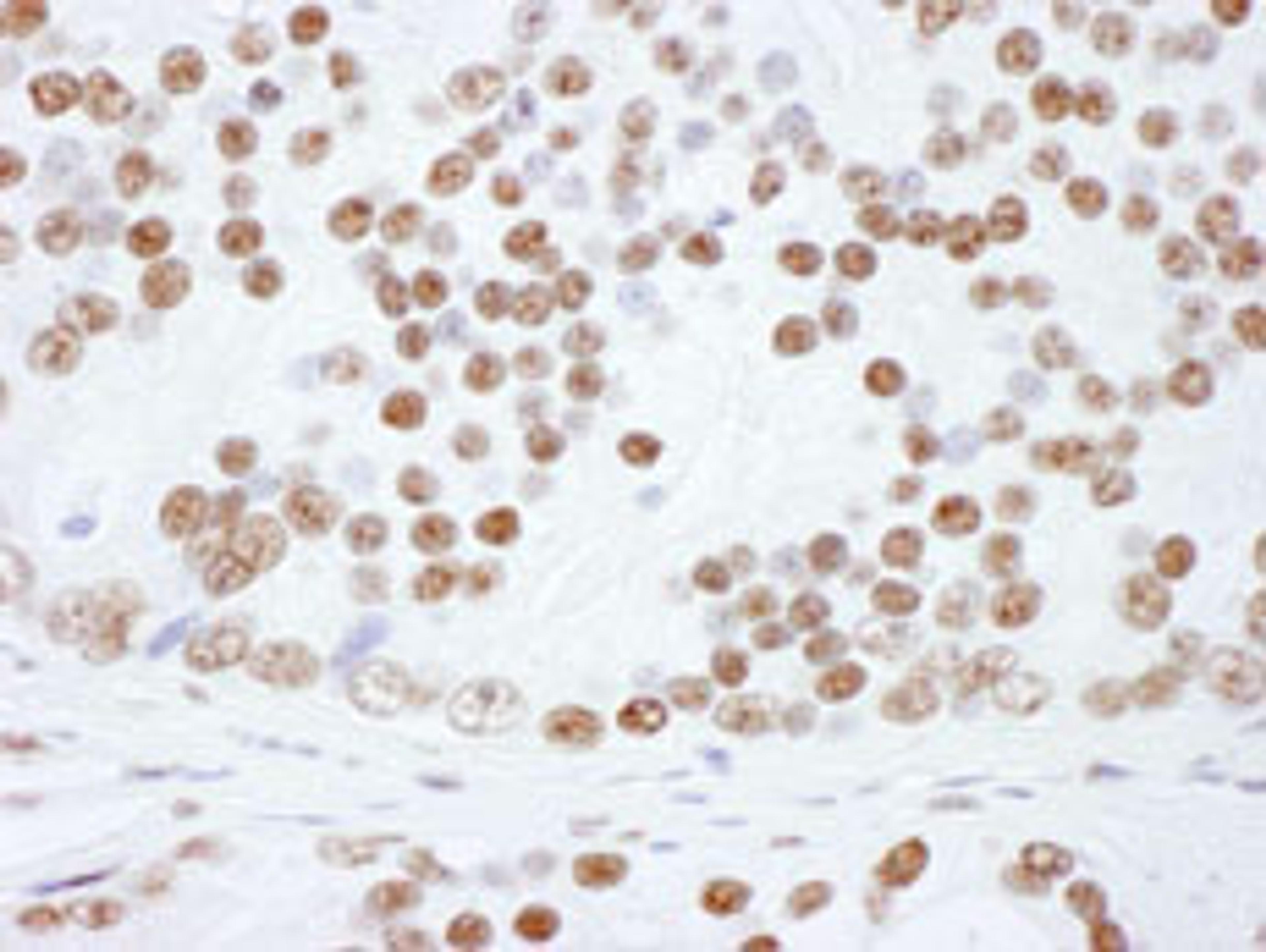 Detection of human hnRNP-L by immunohistochemistry.