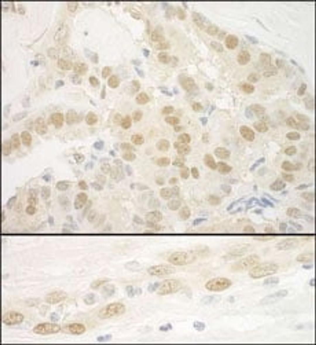 Detection of human MKL2 by immunohistochemistry.