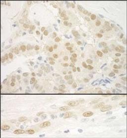 Detection of human MKL2 by immunohistochemistry.