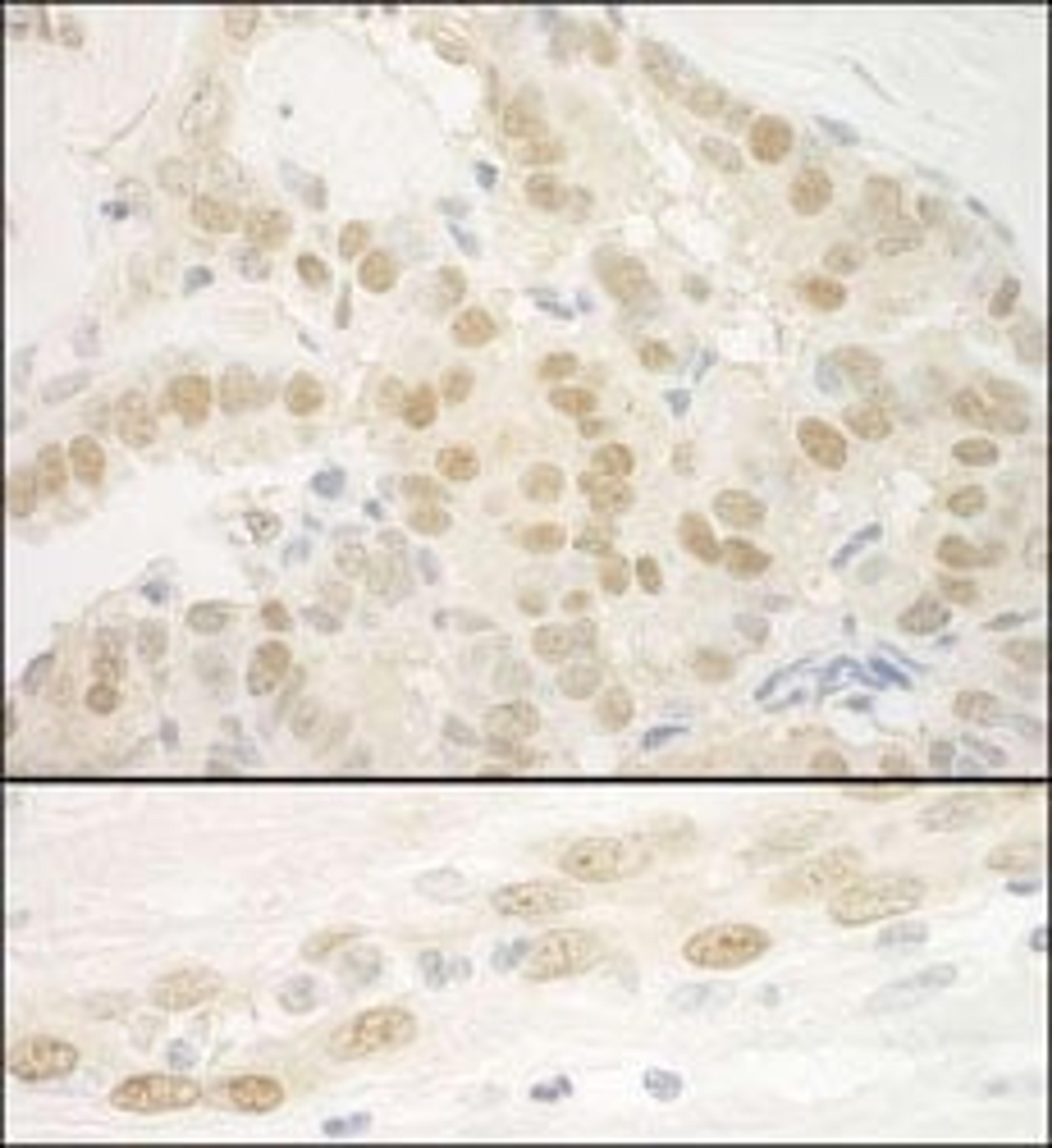 Detection of human MKL2 by immunohistochemistry.