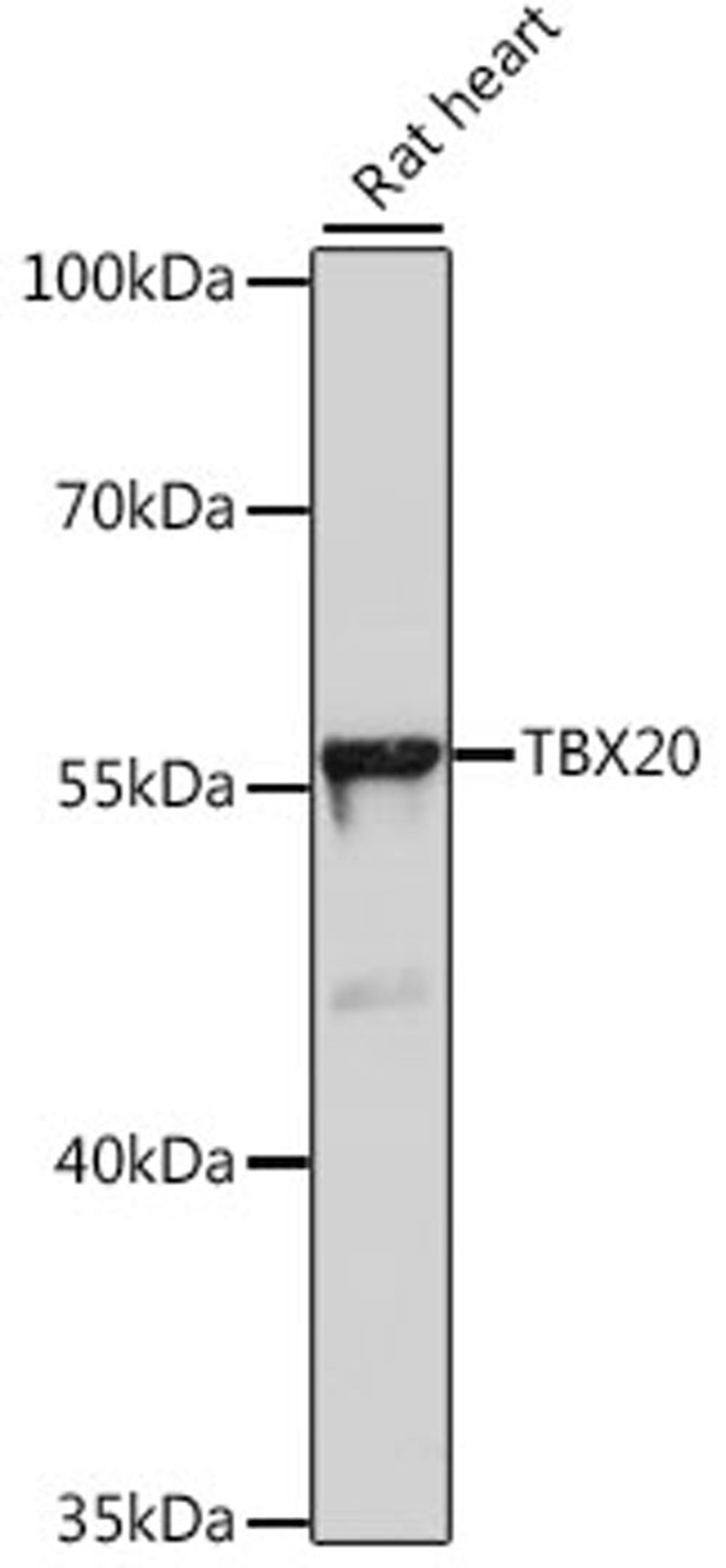 Western blot - TBX20 antibody (A15994)