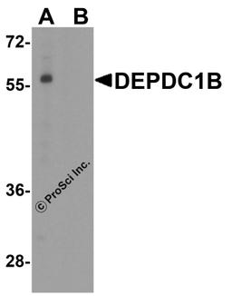 Western blot analysis of DEPDC1B in K562 cell lysate with DEPDC1B antibody at 1 μg/ml in (A) the absence and (B) the presence of blocking peptide.