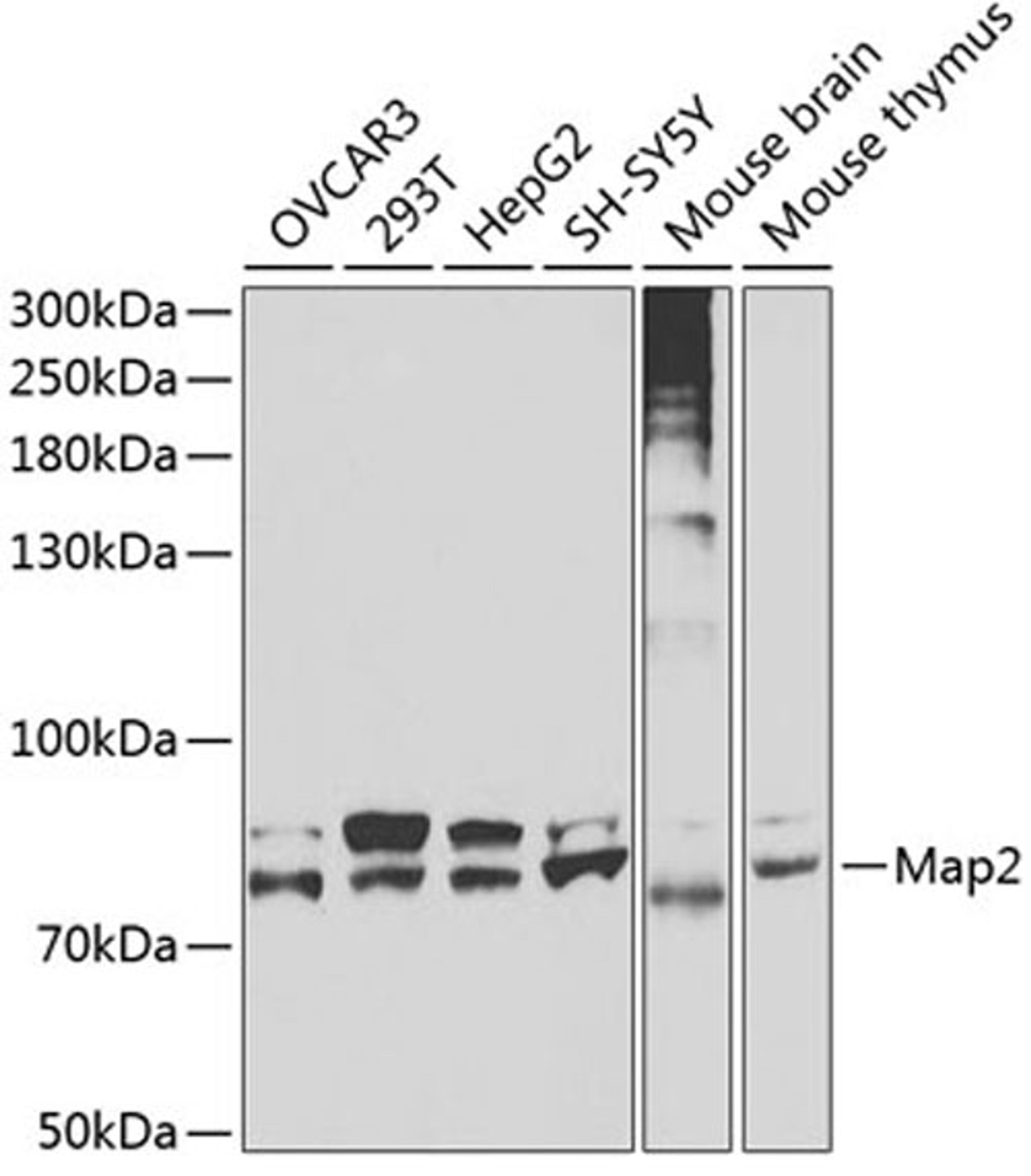 Western blot - Map2 antibody (A3278)
