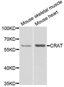 Western blot analysis of extracts of various cell lines using CRAT antibody