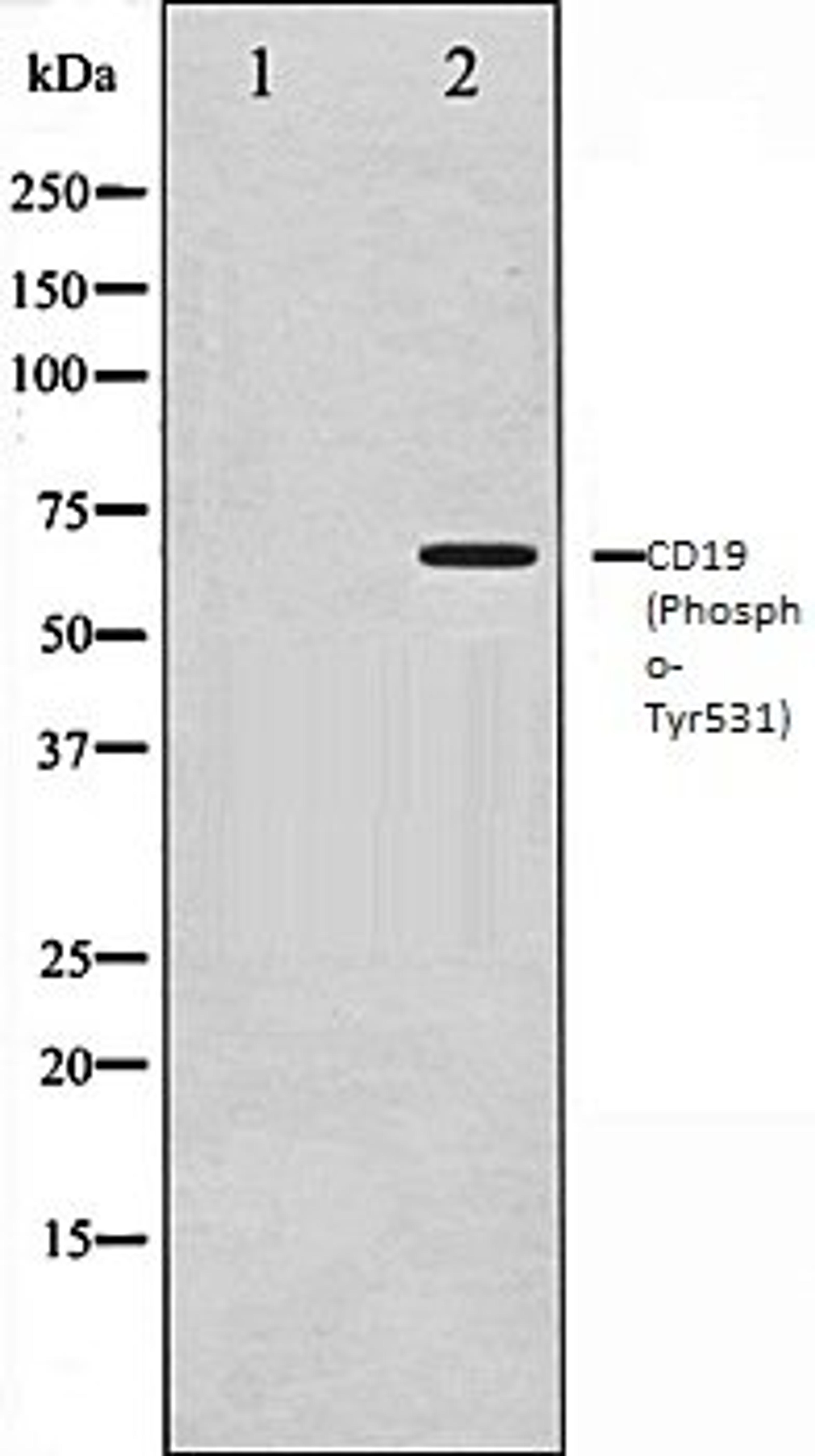 Western blot analysis of COS7 whole cell lysates using CD19 (Phospho-Tyr531) antibody, The lane on the left is treated with the antigen-specific peptide.