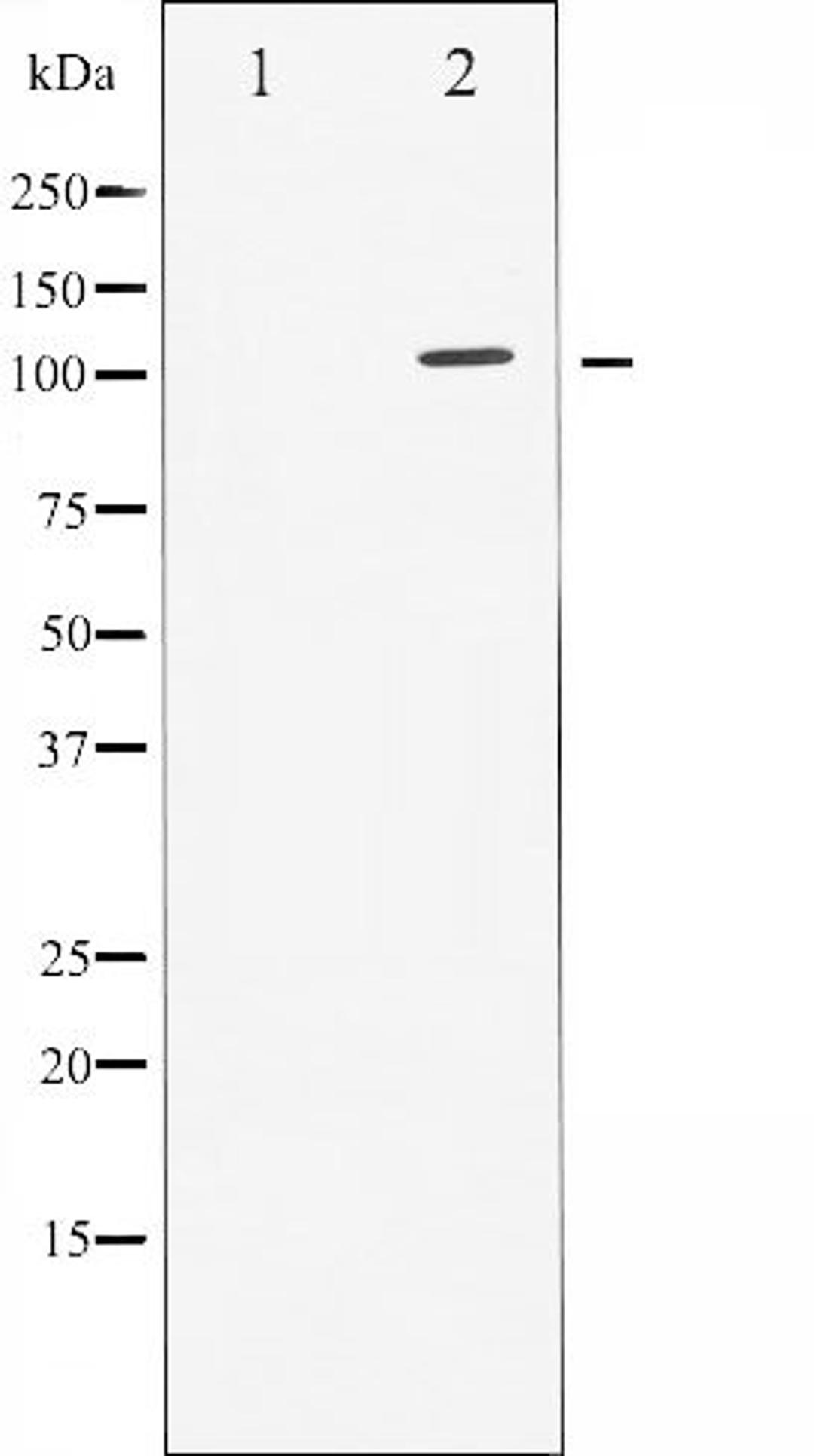 Western blot analysis of HuvEc whole cell lysates using GAB1 (Phospho-Tyr627) antibody