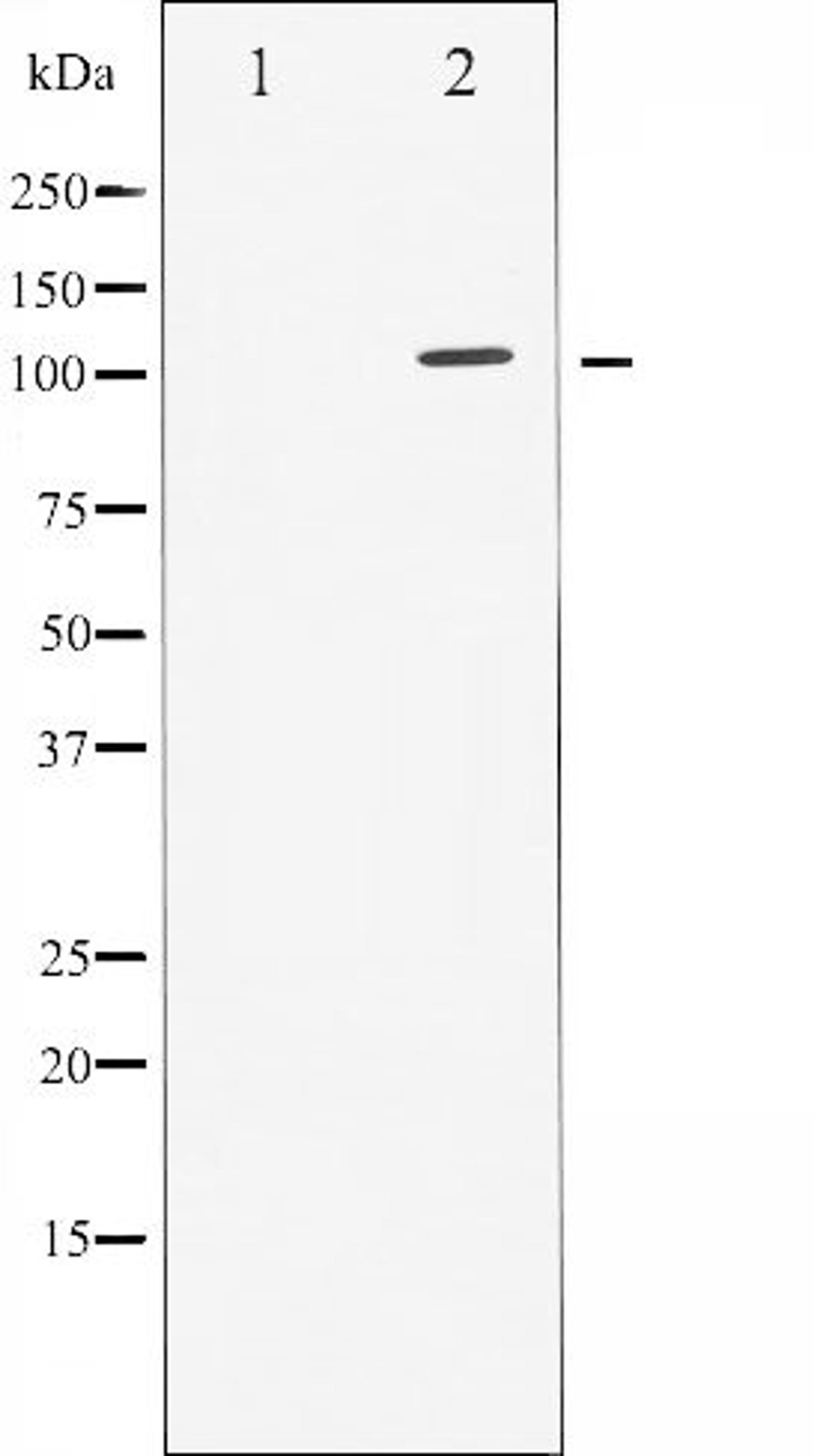 Western blot analysis of HuvEc whole cell lysates using GAB1 (Phospho-Tyr627) antibody