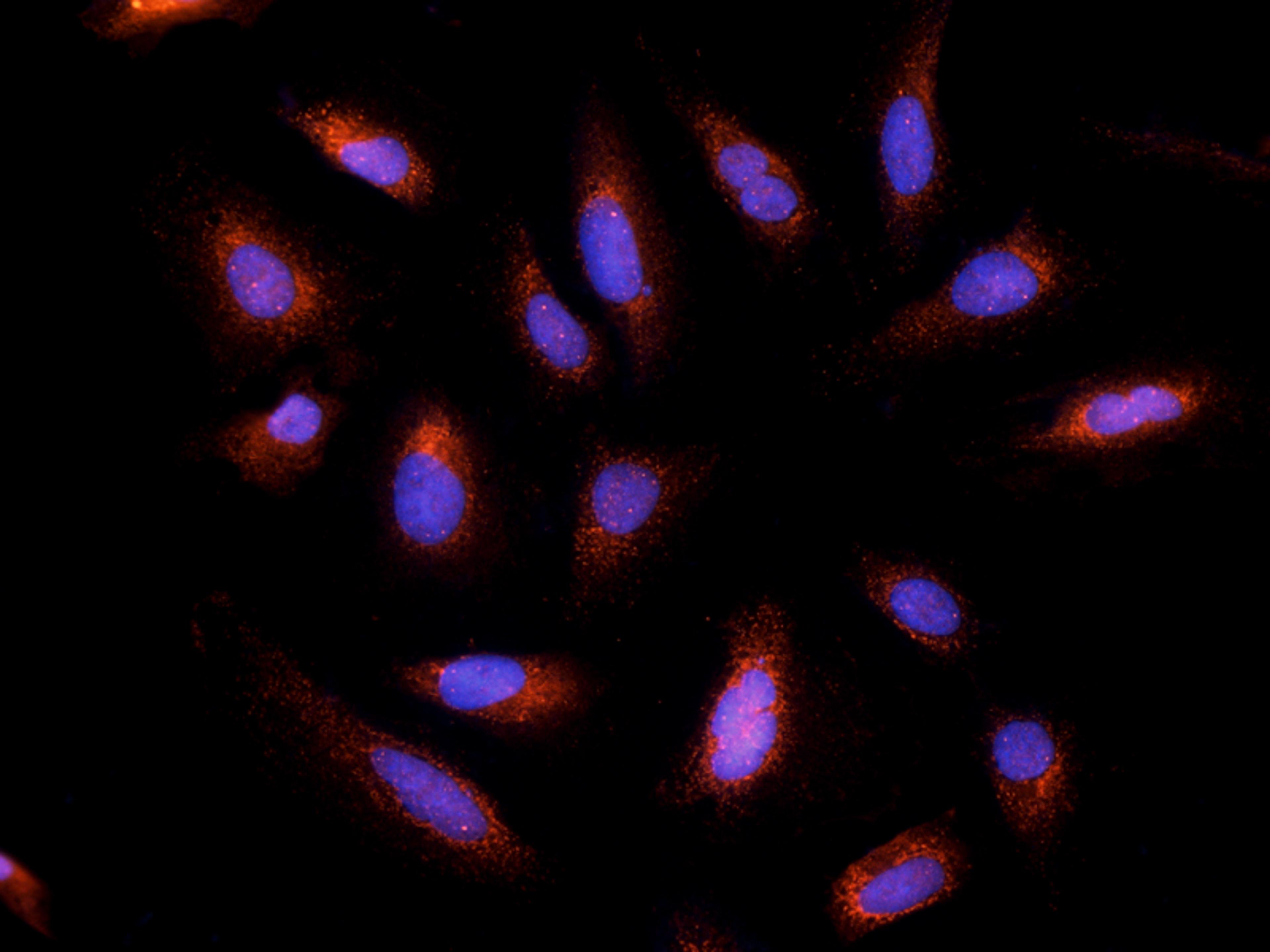 IF analysis of human hela cell tissue using Endothelin 1 antibody (2.5 ug/ml)