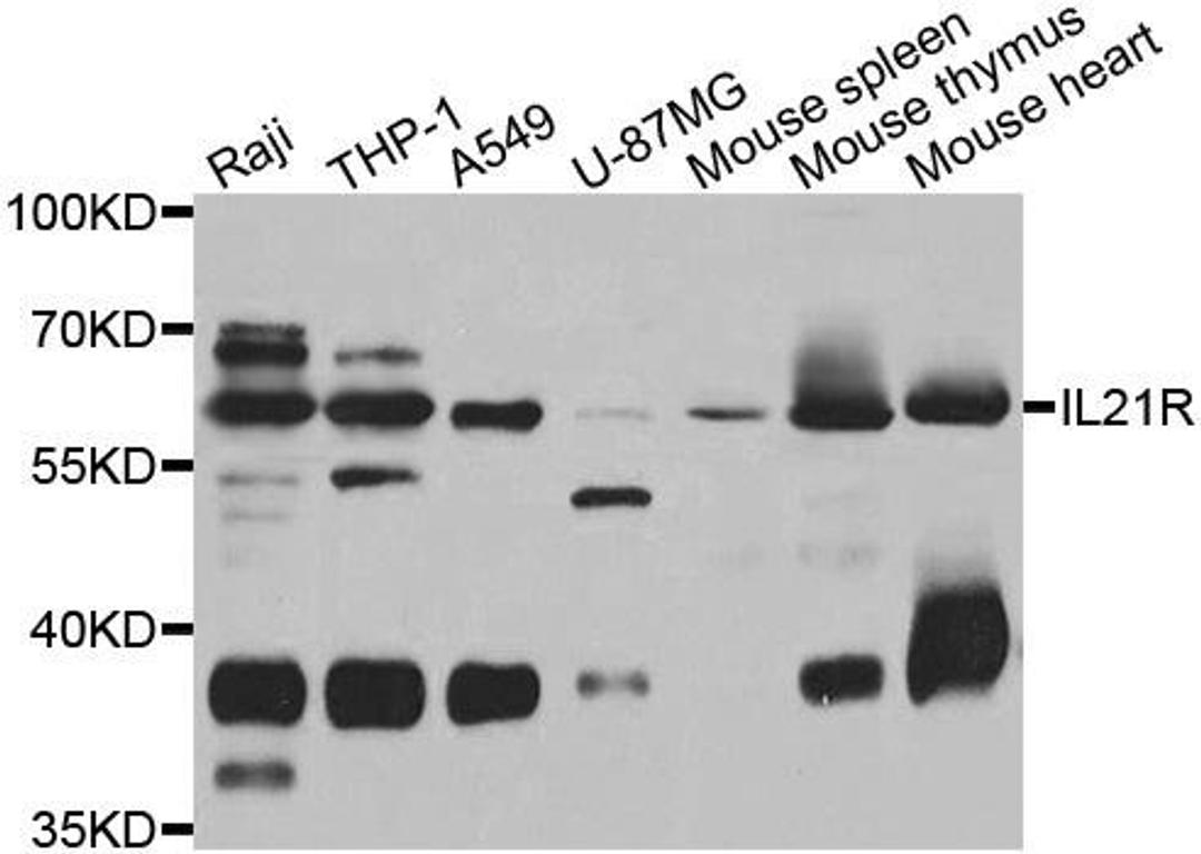 Western blot analysis of extracts of various cell lines using IL21R antibody