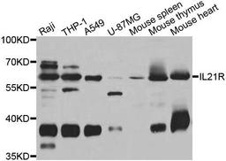 Western blot analysis of extracts of various cell lines using IL21R antibody