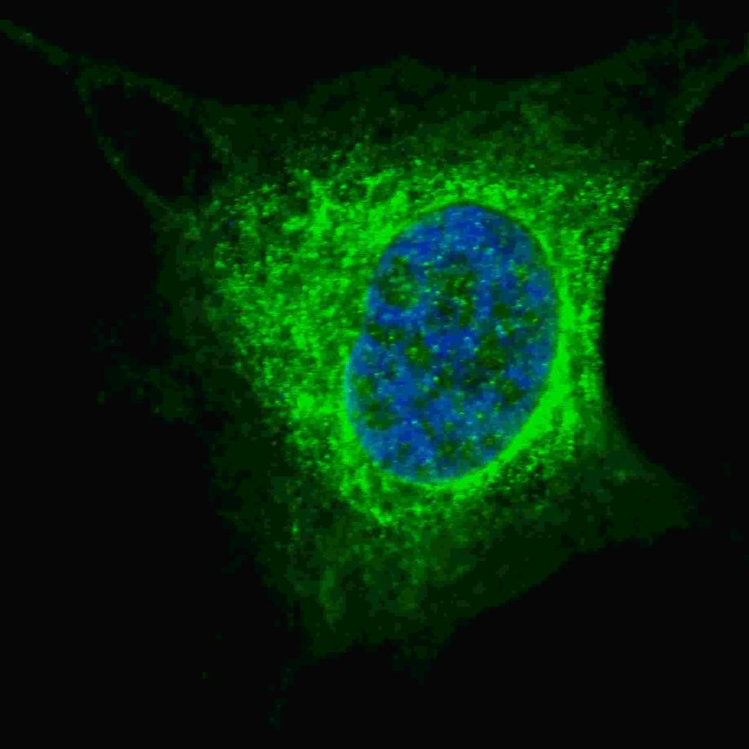 Fluorescent confocal image of SY5Y cells stained with Vimentin (S82) antibody. SY5Y cells were fixed with 4% PFA (20 min), permeabilized with Triton X-100 (0.2%, 30 min). Cells were then incubated with Vimentin (S82) primary antibody (1:200, 2 h at room t