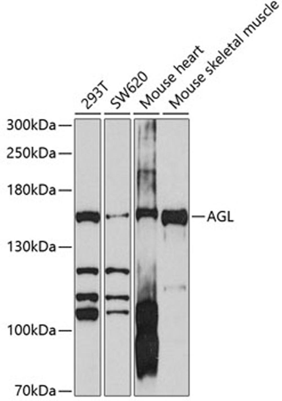 Western blot - AGL antibody (A10051)