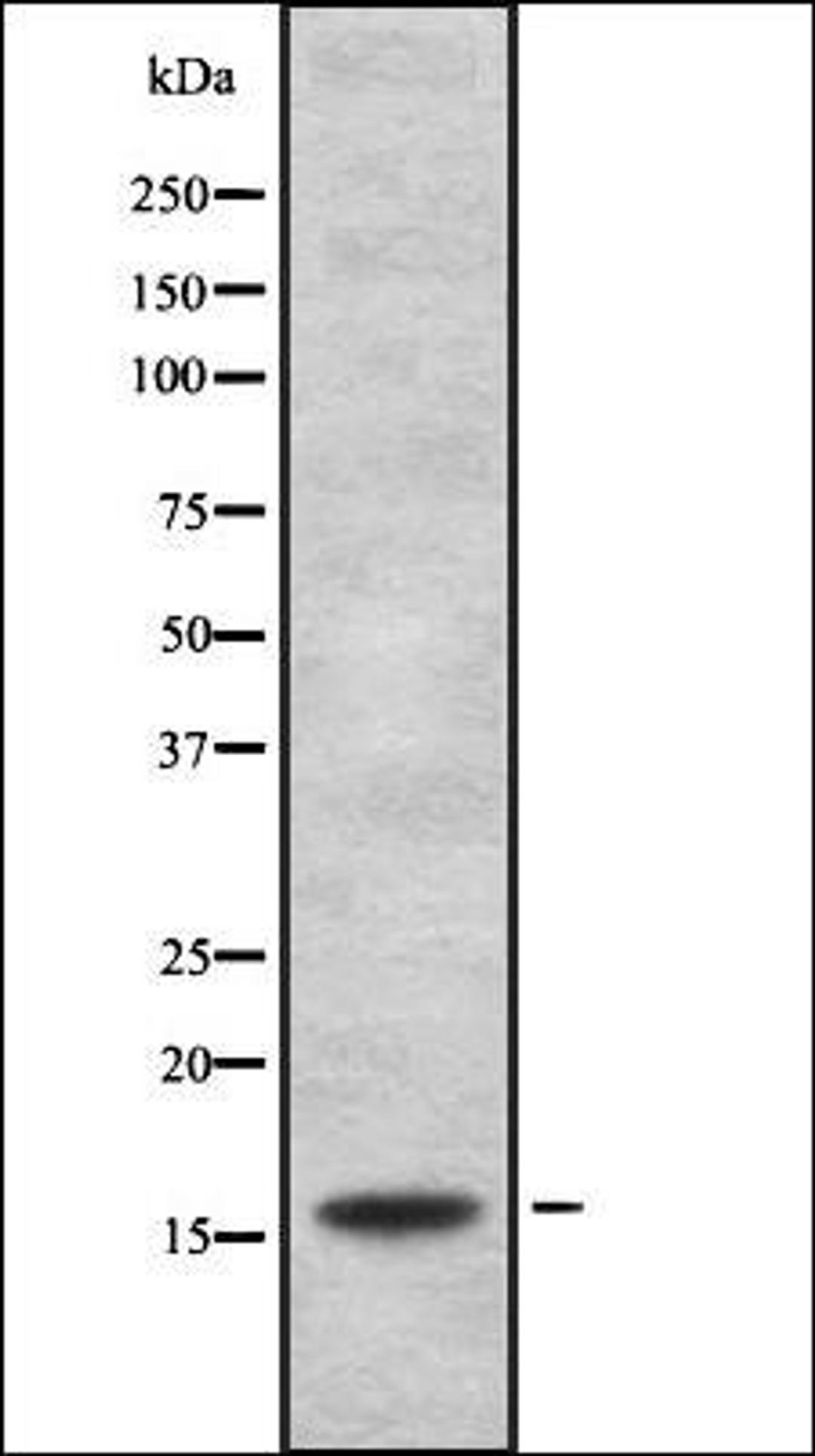 Western blot analysis of HEK293 cells using HSPB3 antibody