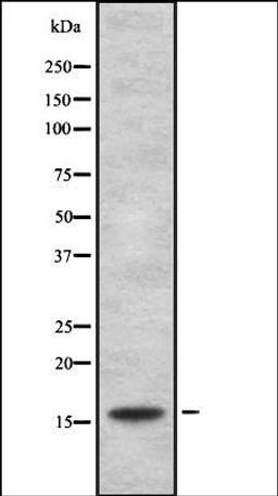 Western blot analysis of HEK293 cells using HSPB3 antibody