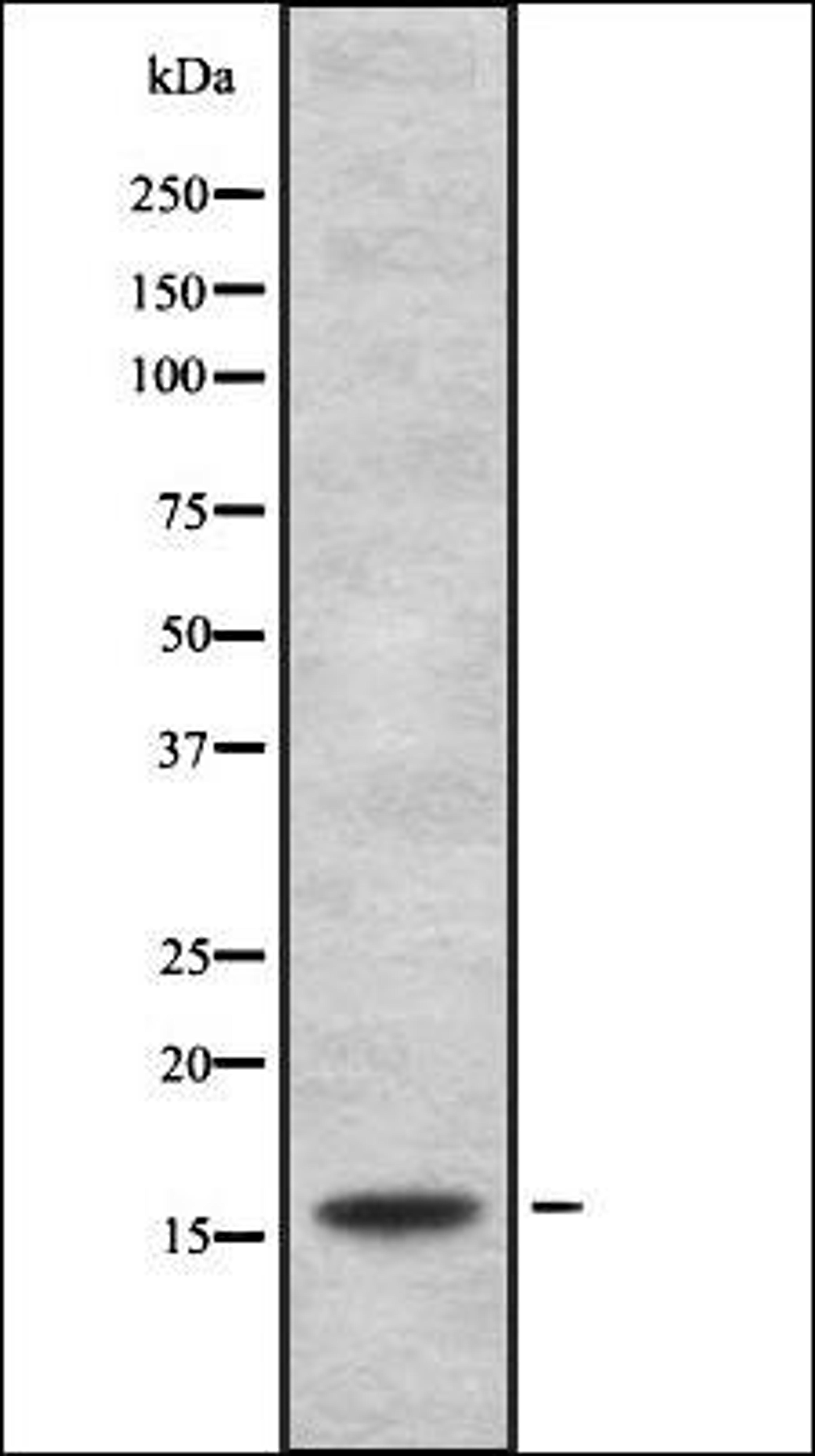 Western blot analysis of HEK293 cells using HSPB3 antibody