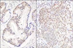 Detection of human and mouse EFTUD2/SNRP116 by immunohistochemistry.